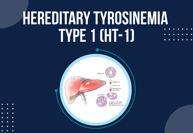 Overview of Tyrosinemia Type 1: Navigating a Rare Genetic Disorder