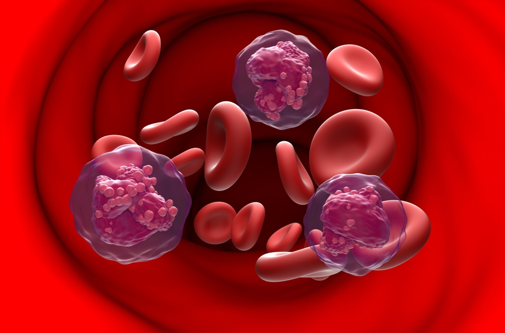 Nelarabine Combination Therapy: Relapsed T-Cell Acute Lymphoblastic Leukemia